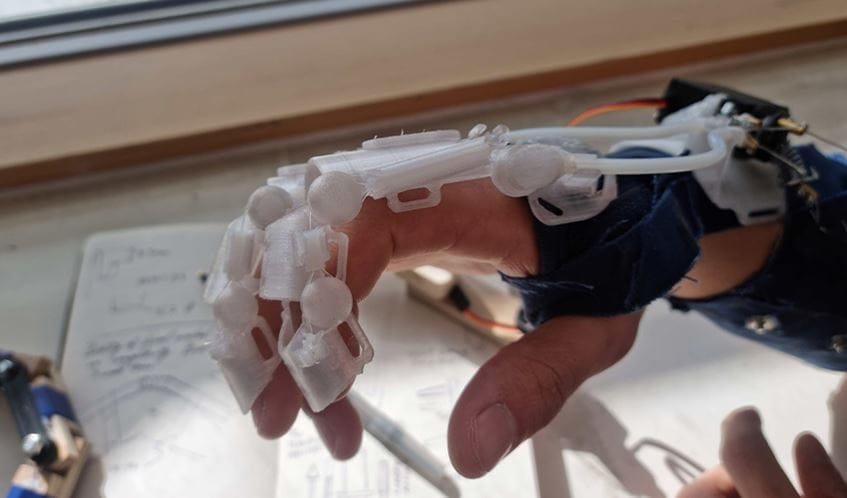 UWE Bristol Student Develops Exoskeletal Bionic Glove to Aid Stroke Recovery