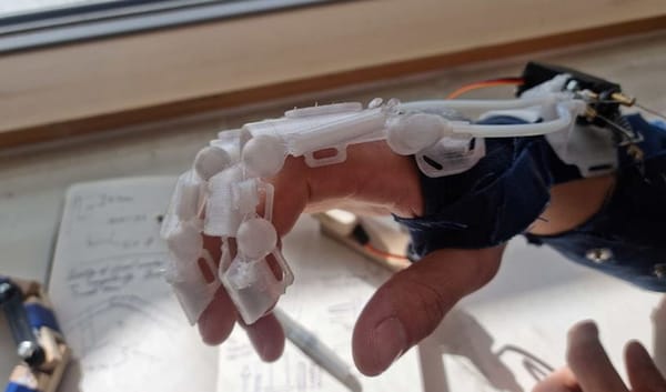 UWE Bristol Student Develops Exoskeletal Bionic Glove to Aid Stroke Recovery
